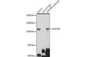 Immunoprecipitation analysis of 300 μg extracts of HeLa cells using 3 μg DGCR8 antibody (ABIN7266761). (DGCR8 antibody)
