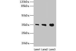 Western blot All lanes: PVRIG antibody at 4 μg/mL Lane 1: Mouse liver tissue Lane 2: Mouse kidney tissue Lane 3: Mouse heart tissue Secondary Goat polyclonal to rabbit IgG at 1/10000 dilution Predicted band size: 35 kDa Observed band size: 35 kDa (PVRIG antibody  (AA 193-326))