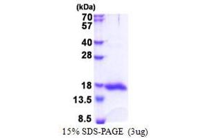 SDS-PAGE (SDS) image for Lectin, Galactoside-Binding, Soluble, 13 (LGALS13) (AA 1-139) protein (His tag) (ABIN5853458) (LGALS13 Protein (AA 1-139) (His tag))
