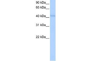 WB Suggested Anti-KLHDC5 Antibody Titration:  0.