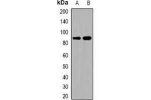 Western blot analysis of ADAM32 expression in HEK293T (A), human testis (B) whole cell lysates. (ADAM32 antibody)