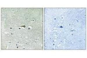Immunohistochemistry analysis of paraffin-embedded human brain tissue using TTK (Ab-676) antibody. (Mps1 antibody  (Thr676))