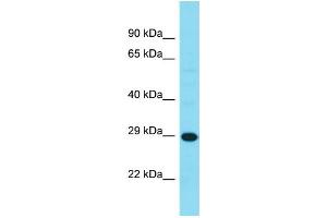 Western Blotting (WB) image for anti-Haloacid Dehalogenase-Like Hydrolase Domain Containing 3 (HDHD3) (C-Term) antibody (ABIN2791573)