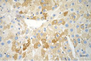 Immunohistochemistry was performed on paraffin-embedded mouse liver using ferritin light chain antibody (ABIN7798597), 1:200).