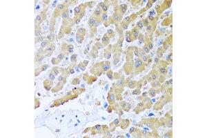 Immunohistochemistry of paraffin-embedded human liver using CCL8 antibody at dilution of 1:100 (40x lens). (CCL8 antibody)