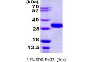 SDS-PAGE (SDS) image for OTU Domain, Ubiquitin Aldehyde Binding 2 (OTUB2) (AA 1-234) protein (His tag) (ABIN667440)