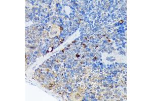Immunohistochemistry (IHC) image for anti-Caspase Recruitment Domain Family, Member 11 (CARD11) antibody (ABIN7266125)