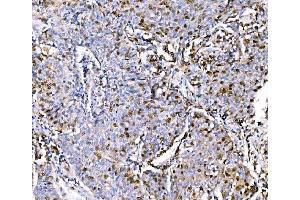 IHC analysis of Geminin/GMNN using anti-Geminin/GMNN antibody (ABIN7600598).