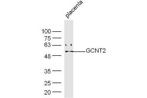 Mouse placenta lysates probed with Rabbit Anti-GCNT Polyclonal Antibody, Unconjugated  at 1:500 for 90 min at 37˚C. (GCNT2 antibody  (AA 151-250))