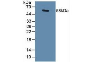 Detection of GABPa in Human Lung Tissue using Polyclonal Antibody to GA Binding Protein Transcription Factor Alpha (GABPa) (GABPA antibody  (AA 168-314))