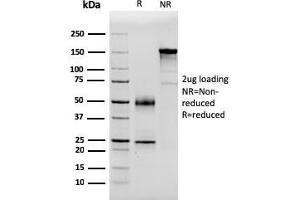 SDS-PAGE Analysis Purified PSA Mouse Monoclonal Antibody (APCS/3240). (APCS antibody  (AA 143-223))