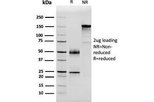 SDS-PAGE Analysis Purified PSA Mouse Monoclonal Antibody (APCS/3240).
