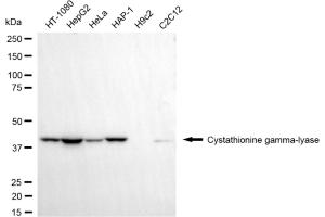 anti-Cystathionase (Cystathionine gamma-Lyase) (CTH) antibody