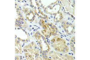 Immunohistochemistry of paraffin-embedded human kidney using HMGCL antibody (ABIN5975709) at dilution of 1/100 (40x lens). (HMGCL antibody)