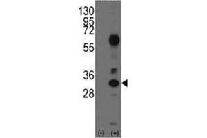 Western blot analysis of CD8A antibody and 293 cell lysate (2 ug/lane) either nontransfected (Lane 1) or transiently transfected with the CD8A gene (2). (CD8 alpha antibody  (AA 59-88))