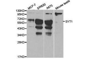 Western Blotting (WB) image for anti-Synaptotagmin I (SYT1) antibody (ABIN1875009) (SYT1 antibody)