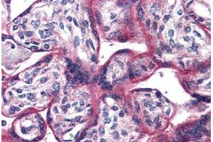 Immunohistochemistry (Formalin-fixed Paraffin-embedded Sections) (IHC (fp)) image for anti-Adenylate Cyclase Activating Polypeptide 1 (Pituitary) Receptor Type I (ADCYAP1R1) (N-Term) antibody (ABIN461703)