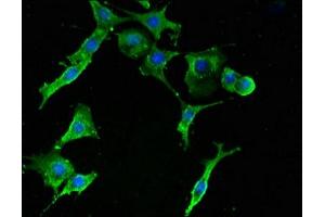Immunofluorescent analysis of MCF-7 cells using ABIN7142512 at dilution of 1:100 and Alexa Fluor 488-congugated AffiniPure Goat Anti-Rabbit IgG(H+L) (RPS2 antibody  (AA 2-61))
