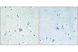 Immunohistochemistry (IHC) image for anti-Adenosine A2a Receptor (ADORA2A) (AA 321-370) antibody (ABIN2890802)
