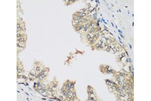 Immunohistochemistry of paraffin-embedded Human prostate using RRM1 Polyclonal Antibody at dilution of 1:200 (40x lens). (RRM1 antibody)