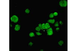 Immunofluorescent analysis of MCF-7 cells using ABIN7161758 at dilution of 1:100 and Alexa Fluor 488-congugated AffiniPure Goat Anti-Rabbit IgG(H+L) (NFIC antibody  (AA 201-428))