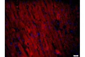 Paraformaldehyde-fixed, paraffin embedded Mouse heart tissue, Antigen retrieval by boiling in sodium citrate buffer(pH6) for 15min, Block endogenous peroxidase by 3% hydrogen peroxide for 20 minutes, Blocking buffer (normal goat serum) at 37°C for 30min, Antibody incubation with RNF169 Polyclonal Antibody, Unconjugated  at 1:400 overnight at 4°C, followed by a conjugated secondary and DAPI staining (RNF169 antibody)