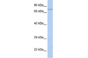 WB Suggested Anti-IGF1R Antibody Titration:  0. (IGF1R antibody  (Middle Region))