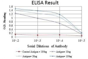 Red: Control Antigen (100 ng), Purple: Antigen (10 ng), Green: Antigen (50 ng), Blue: Antigen (100 ng), (Glucocorticoid Receptor antibody)