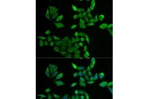 Immunofluorescence analysis of U2OS cells using PNP Polyclonal Antibody (PNP antibody)