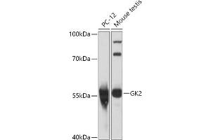 Western blot analysis of extracts of various cell lines, using GK2 antibody (ABIN7267458) at 1:1000 dilution. (GK2 antibody  (AA 1-150))