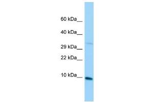 Host: Rabbit Target Name: MRPL36 Sample Type: Jurkat Whole Cell lysates Antibody Dilution: 1. (MRPL36 antibody  (C-Term))