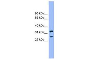Image no. 1 for anti-Fc Fragment of IgE Receptor Ia (FCER1A) (AA 35-84) antibody (ABIN6744794) (Fc epsilon RI/FCER1A antibody  (AA 35-84))