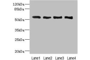 Western blot All lanes: VANGL2 antibody at 2. (VANGL2 antibody  (AA 1-110))