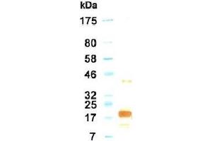 Western Blotting (WB) image for anti-Interleukin 11 (IL11) antibody (ABIN933586) (IL-11 antibody)