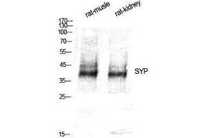 Western Blotting (WB) image for anti-Synaptophysin (SYP) (Internal Region) antibody (ABIN3177577) (Synaptophysin antibody  (Internal Region))