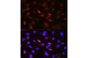 Immunofluorescence analysis of NIH/3T3 cells using Phospho-Jak1-Y1022/1023 antibody (ABIN6135246, ABIN6136118, ABIN6136119 and ABIN6225560) at dilution of 1:100. (JAK1 antibody  (pTyr1022, pTyr1023))