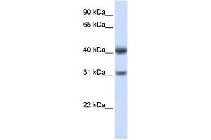 PDSS2 antibody used at 1 ug/ml to detect target protein. (PDSS2 antibody)