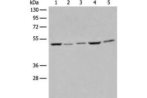 Western blot analysis of Raji Hela A549 HEPG2 and 231 cell lysates using EIF4A3 Polyclonal Antibody at dilution of 1:500 (EIF4A3 antibody)