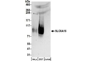 anti-Solute Carrier Family 6 (Neutral Amino Acid Transporter), Member 15 (SLC6A15) (AA 650-700) antibody