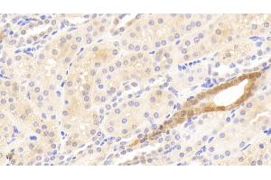 Detection of MMP13 in Human Kidney Tissue using Polyclonal Antibody to Matrix Metalloproteinase 13 (MMP13) (MMP13 antibody  (AA 290-468))
