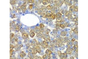 Immunohistochemistry of paraffin-embedded Mouse liver using FAH Polyclonal Antibody at dilution of 1:100 (40x lens). (FAH antibody)