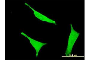 Immunofluorescence of monoclonal antibody to CD38 on HeLa cell. (CD38 antibody  (AA 201-300))