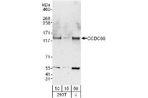 Western Blotting (WB) image for anti-Coiled-Coil Domain Containing 66 (CCDC66) (AA 898-948) antibody (ABIN7453052)