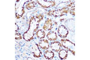 Immunohistochemistry of paraffin-embedded mouse kidney using M Rabbit pAb (ABIN6130539, ABIN6143505, ABIN6143506 and ABIN6221614) at dilution of 1:100 (40x lens). (MAP4 antibody  (AA 942-1152))