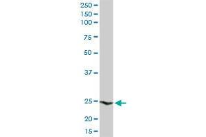 HSPB1 MaxPab rabbit polyclonal antibody. (HSP27 antibody  (AA 1-205))