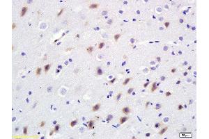 Formalin-fixed and paraffin embedded rat brain labeled with Anti-Bdkrb2/B2R Polyclonal Antibody, Unconjugated  at 1:200 followed by conjugation to the secondary antibody and DAB staining.