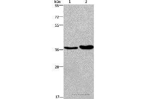Western blot analysis of Human testis tissue and transitional cell carcinoma of bladder tissue, using FUT1 Polyclonal Antibody at dilution of 1:250 (FUT1 antibody)