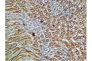 Expression of Na+/K+ ATPase α1 (ATP1A1) in rat kidney - Immunohistochemical staining of paraffin embedded rat kidney sections using Anti-Alpha 1 Na+/K+ ATPase Antibody (ABIN7043659, ABIN7044637 and ABIN7044638), (1:200). (ATP1A1 antibody  (Intracellular, N-Term))