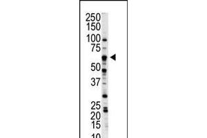Western blot analysis of anti-NLK Pab in A375 cell lysate (Nemo-Like Kinase antibody  (C-Term))
