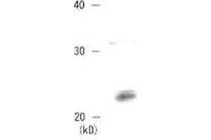 Western Blotting (WB) image for anti-Chromobox Homolog 3 (CBX3) (C-Term) antibody (ABIN2452035)